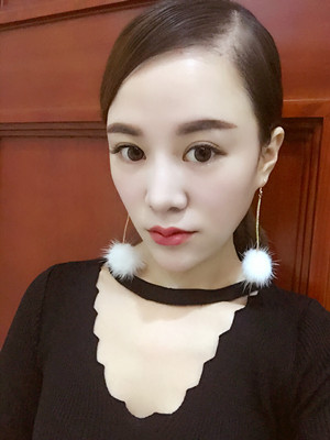 埋线面b提拉一个月之后还是美美哒