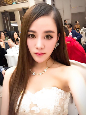 埋线面b提拉一个月之后还是美美哒