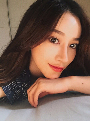 隆鼻整形手术之后更上镜了哟