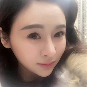 自体脂肪填充面部前后过程以及对比照片，真实案例分享