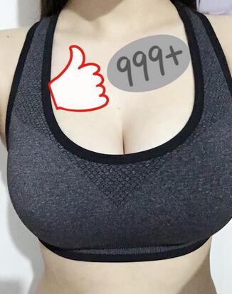 上海韩镜曼托假体隆胸18天