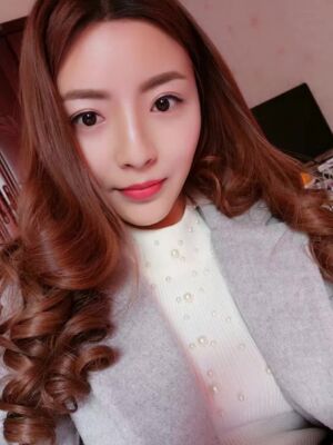 自体脂肪全脸填充之后脸变小了也更精致了