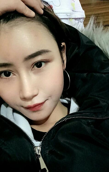 冯斌做的自体脂肪全脸填充大家帮我看看果怎么样