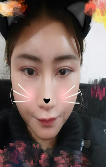 冯斌做的自体脂肪全脸填充大家帮我看看果怎么样