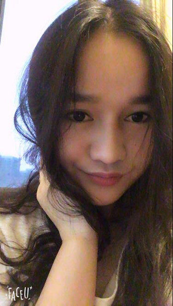 做了隆鼻整形手术整个鼻子灵巧了许多 快来围观果