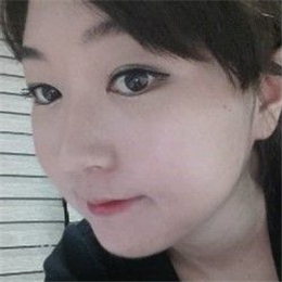 下颌角整形手术前后对比果图片分享，还有恢复过程心路历程~~~