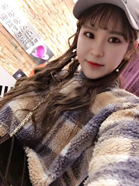 自体脂肪垫下巴前后手术过程以及对比恢复照片分享