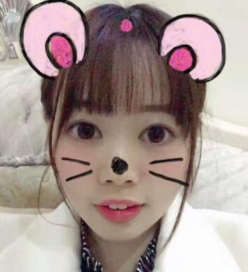 深圳晨曦三点定位双眼皮日记