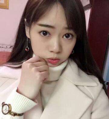 深圳晨曦三点定位双眼皮日记