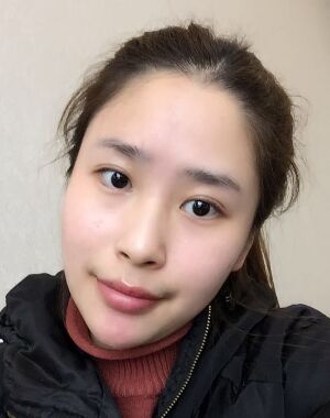 深圳美莱整形医院做了进口硅胶垫下巴脸型都变好看了