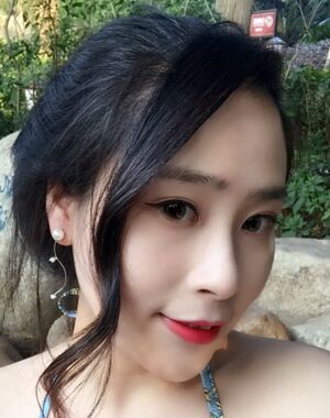 深圳美莱整形医院做了进口硅胶垫下巴脸型都变好看了