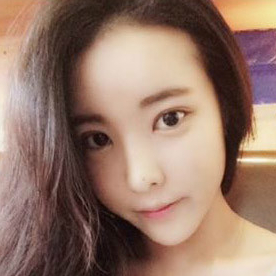 鹰钩鼻矫正整形手术恢复过程和前后对比果图片，分享给大家~