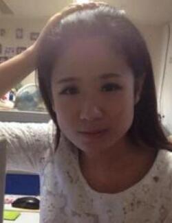 计划了很久要去做磨骨整形