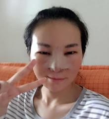 真人记录了硅胶隆隆鼻整形手术前后过程，大家进来看看吧!