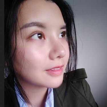 假体隆鼻两个月后的感觉 隆鼻整形手术恢复日记