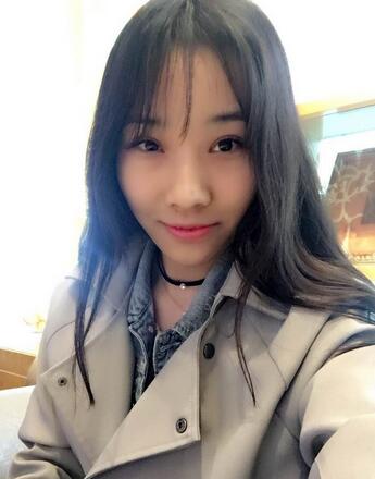 开眼角加双眼皮15天恢复图