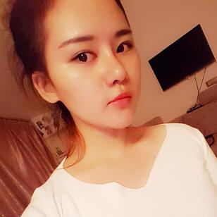 假体垫下巴一个月 前后对比