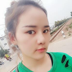 假体垫下巴一个月 前后对比