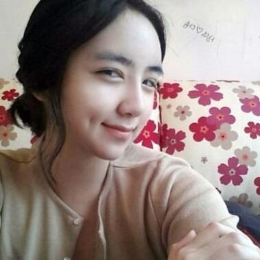 切开双眼皮和硅胶假体隆鼻手术前后对比果图片分享~