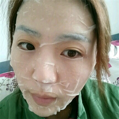 光子嫩肤和下巴脂肪填充术后果图片分享，董萍门诊做的~