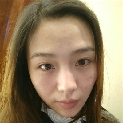 光子嫩肤和下巴脂肪填充术后果图片分享，董萍门诊做的~