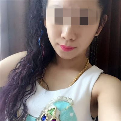 玻尿酸填充泪沟恢复过程和前后对比果图片分享~