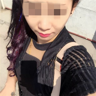 玻尿酸填充泪沟恢复过程和前后对比果图片分享~