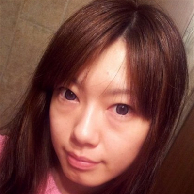 激光溶脂去眼袋恢复过程和前后对比果图片分享哦~