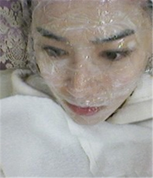 元旦做的光子嫩肤，分享恢复过程和前后对比果照片哦~