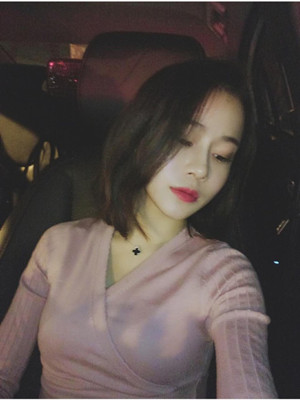 你们看看我做的综合隆鼻手术怎么样