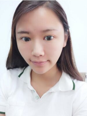 自体脂肪面部填充后恢复，成活率还蛮高的