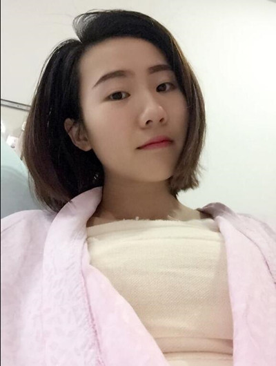 假体隆胸拯救了我的小平胸 快来看看我的果怎么样