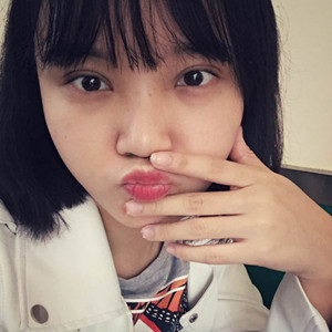 北京美莱做了双眼皮手术，分享前后对比果图片~