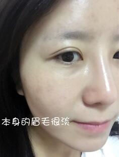 眉毛种植果分享