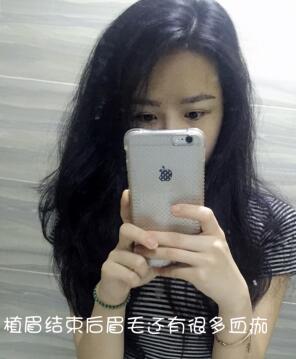 眉毛种植果和成长过程分享