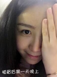 眉毛种植价格4800元，植眉果和成长过程分享