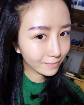 眉毛种植第二天