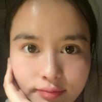 眉毛种植果和整形图片分享