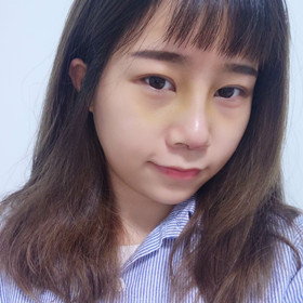 去年11月做的膨体隆鼻手术，终于摆脱我的塌鼻梁了