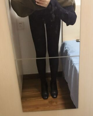 大腿抽脂的亲身经历，恢复情况还不错