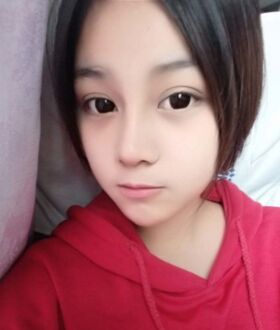 隆鼻整形日记，像变了个人似的