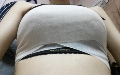 我的假体隆胸让我从小平胸变深V 果还不错