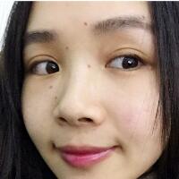 脸上激光去痣日志分享，一共去痣2次