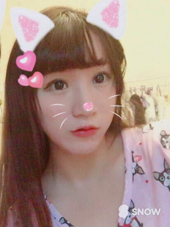 我做了玻尿酸丰唇和玻尿酸丰下巴 果还不错哦