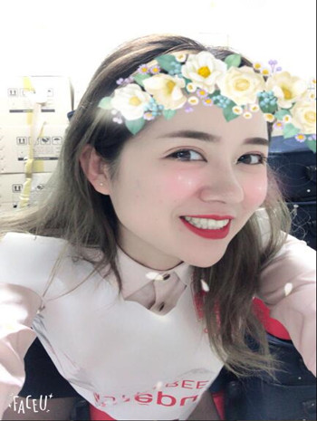 我的隆鼻整形加玻尿酸丰额头以及B****的真实经历