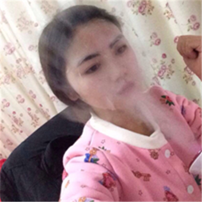 磨下颌角磨颧骨手术恢复过程和前后对比果照片分享哦~