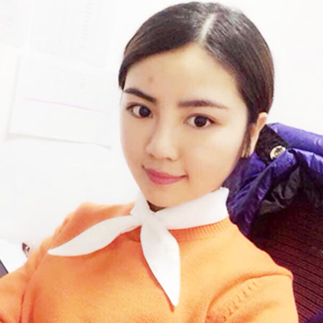 磨下颌角磨颧骨手术恢复过程和前后对比果照片分享哦~