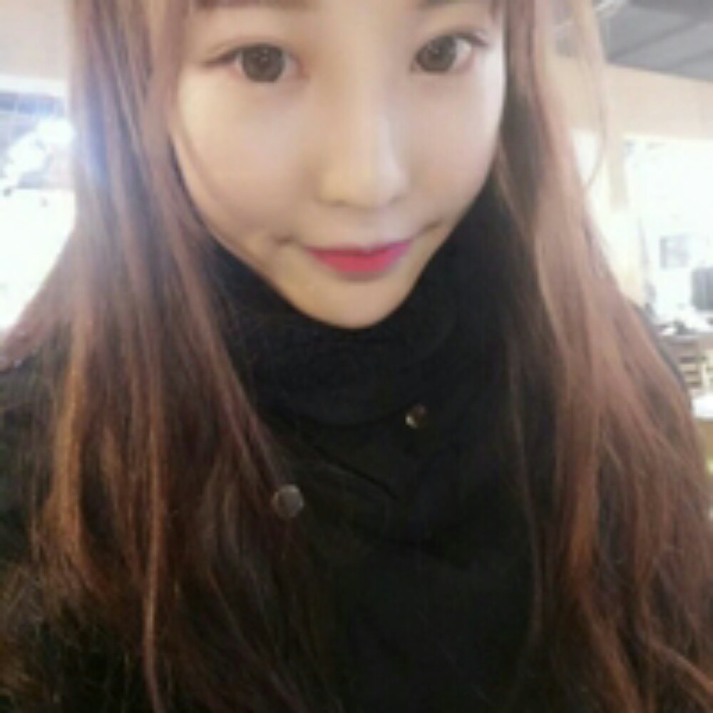 耳软骨隆鼻尖+自体脂肪填充全脸恢复前后对比果照片分享~