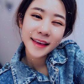 切开双眼皮+开内眼角手术前后过程，还有对比照片哟!