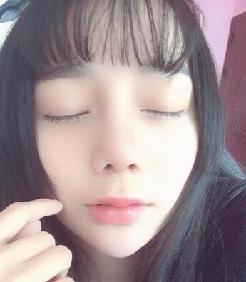 隆鼻修复术后恢复期经历